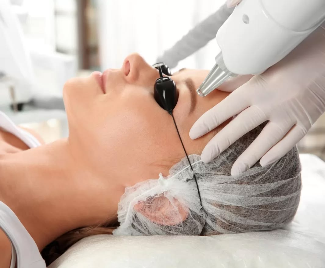 Q-Switched Nd:YAG Laser