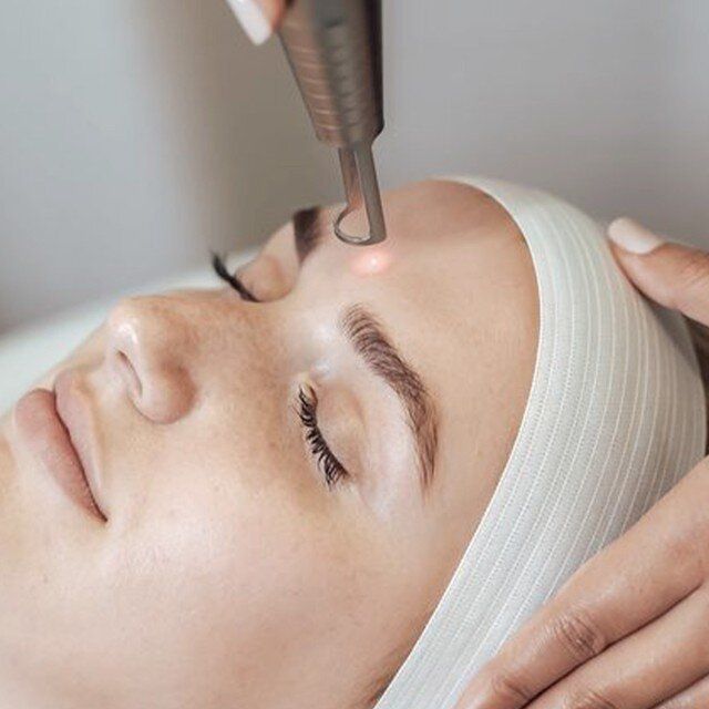 Laser Toning