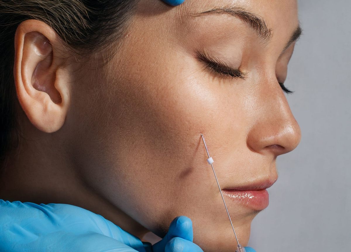Suction Blister Grafting