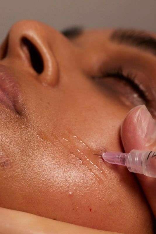 Electrosurgery